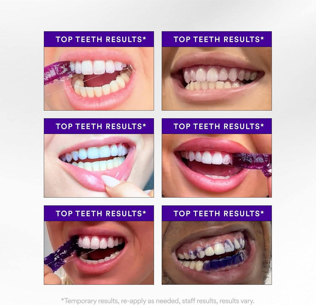💜 NEXISIFY PURPLE WHITENING STRIPS ✨ 28 Strips | 14 Treatments